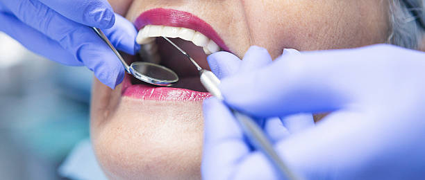 Best Emergency Treatment for Dental Infections or Abscesses in Spring Park, MN